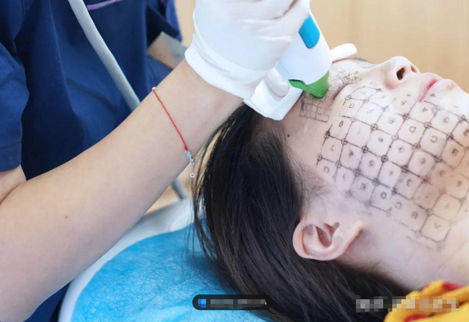 热玛吉和超声刀怎么选？上海光电抗衰一篇讲清
